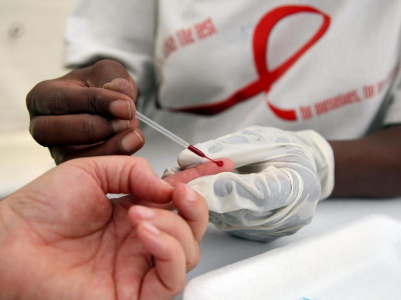 A 75% aumentaron muertes de pacientes con SIDA en Venezuela