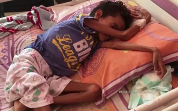 Por desnutrición muere niño en hospital de Guanare